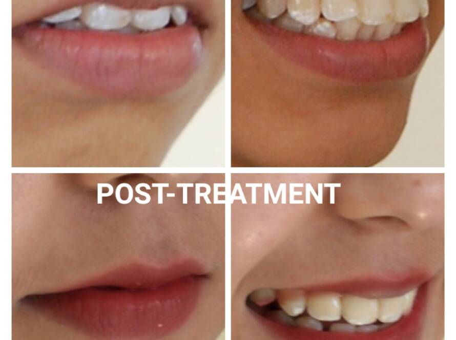 Is your floss toxic? Find a safe one! Happy Dental Clinic