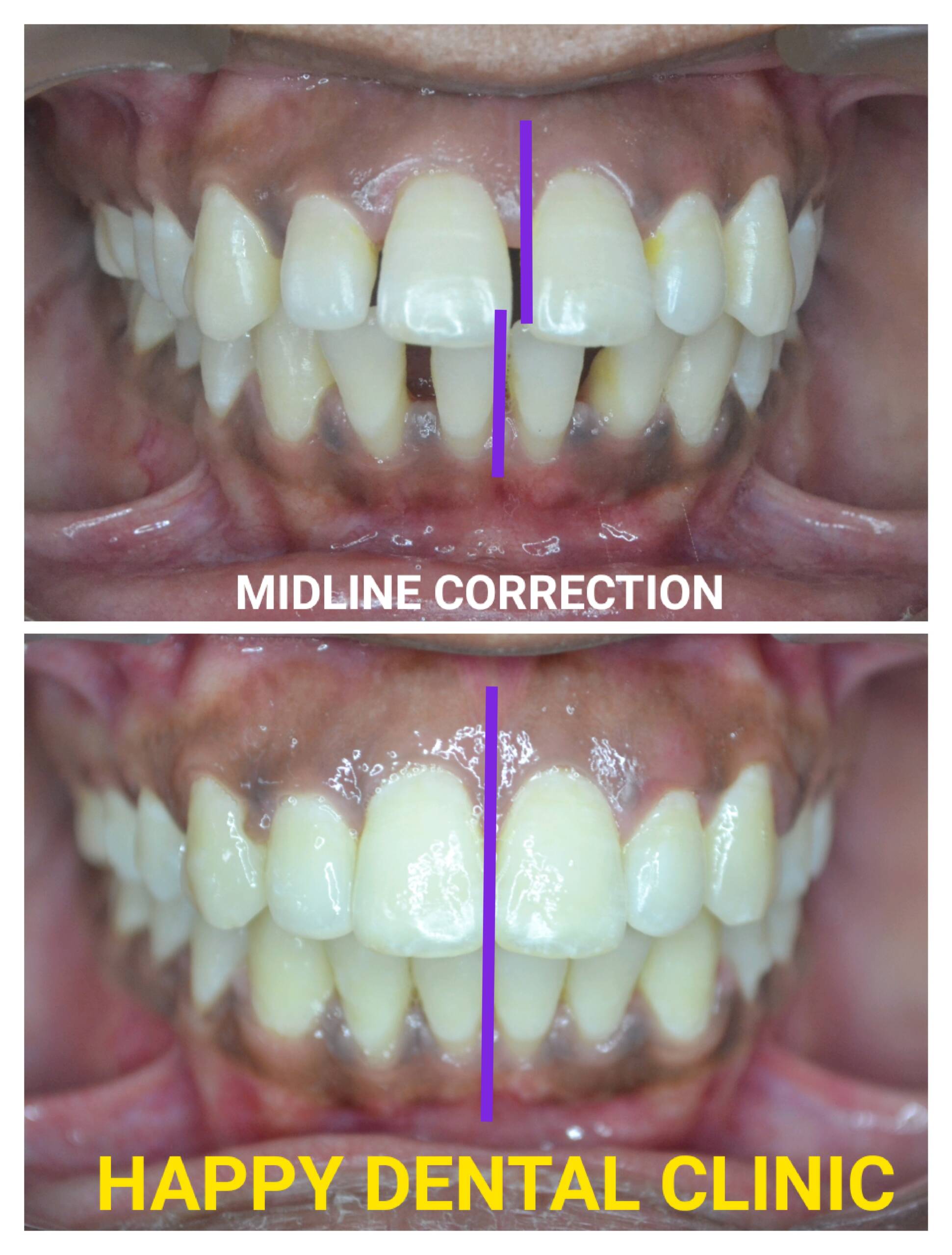 Is Your Floss Toxic? Find A Safe One! - Happy Dental Clinic