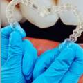 A Perfect Solution for alternative to traditional braces