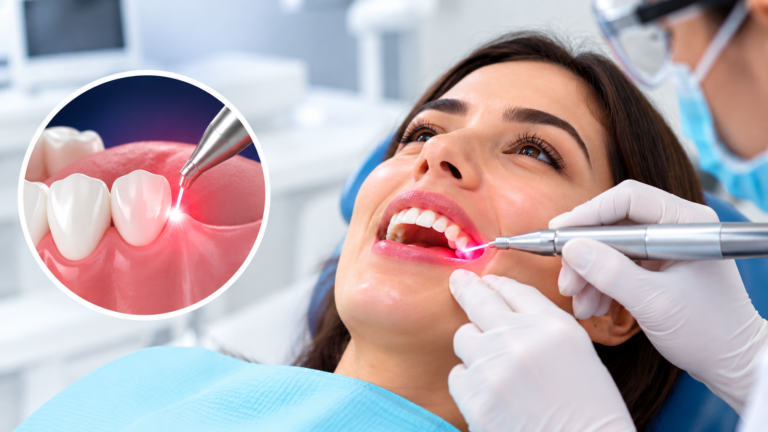 Laser Dentistry in Chandkheda, Ahmedabad